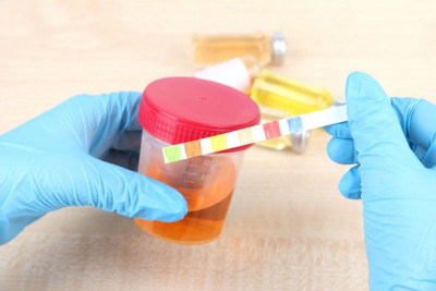 Urine Gelap, Kenapa?